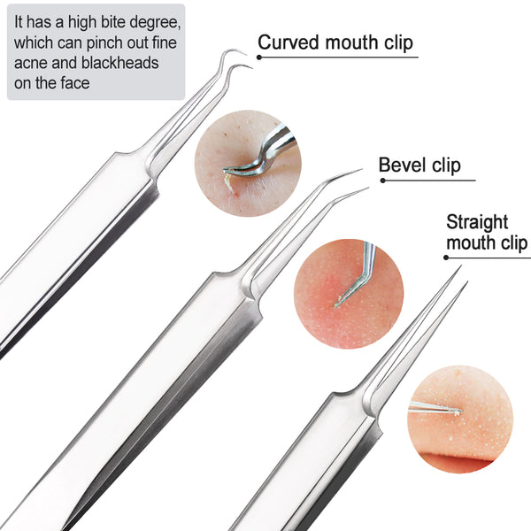 Mitesser und Pickel entferner Set aus hochwertigem Edelstahl 5 teilig